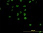 CSE1L Antibody (monoclonal) (M04)